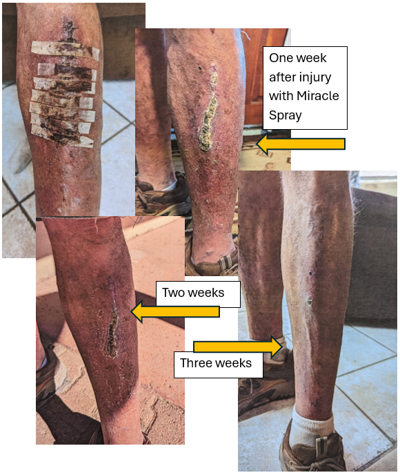 Images of leg injury